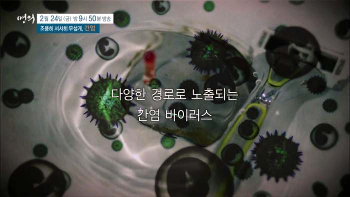 명의 A형 B형 C형 간염 증상 예방접종 원인 전염 항체 검사 비용 방법