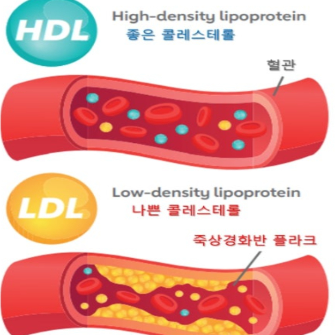 콜레스테롤 수치 정상