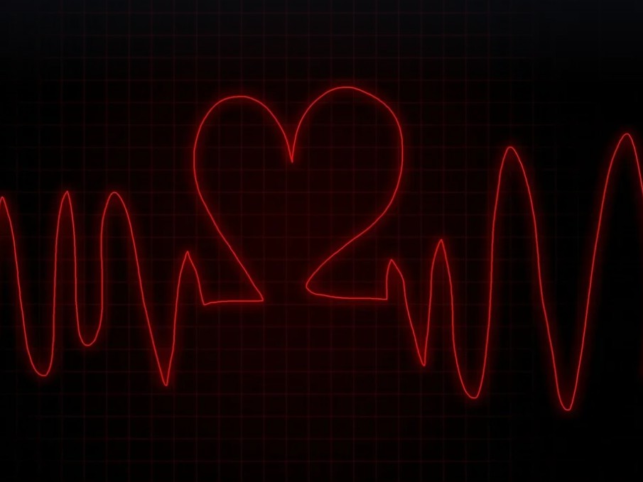 심장 비트 모니터 이미지