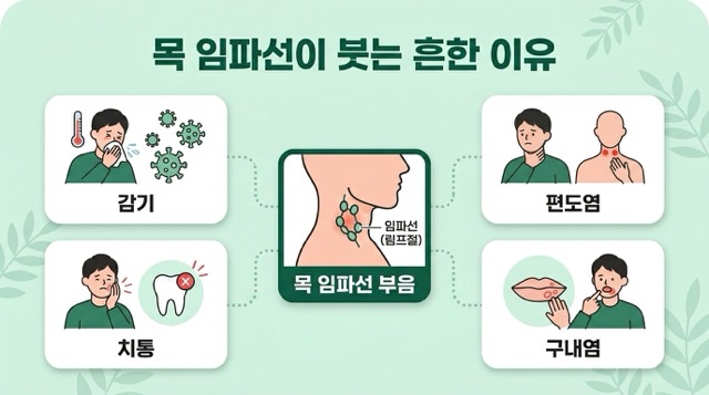 감기 편도염 치통과 목 임파선염 연결