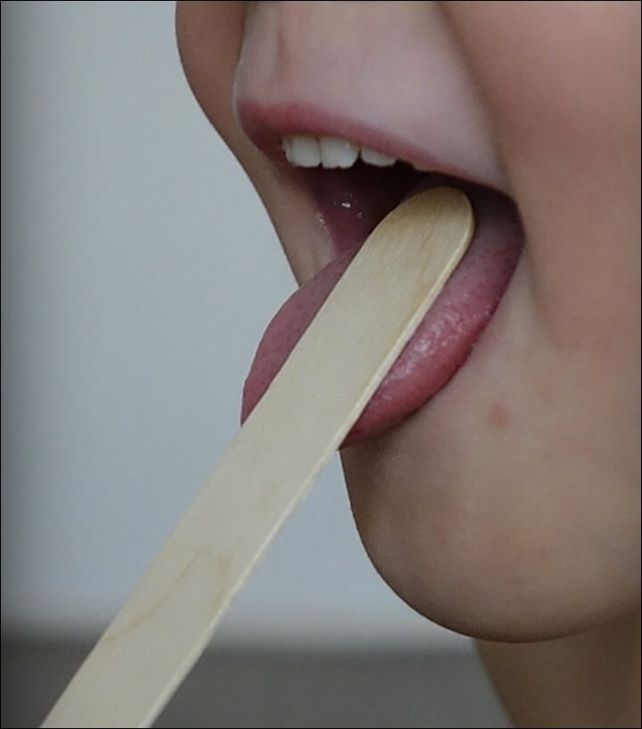 혓바늘이 없애는방법