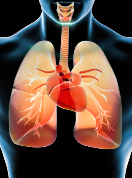 급성 호흡곤란 증후군과 관련된 사진