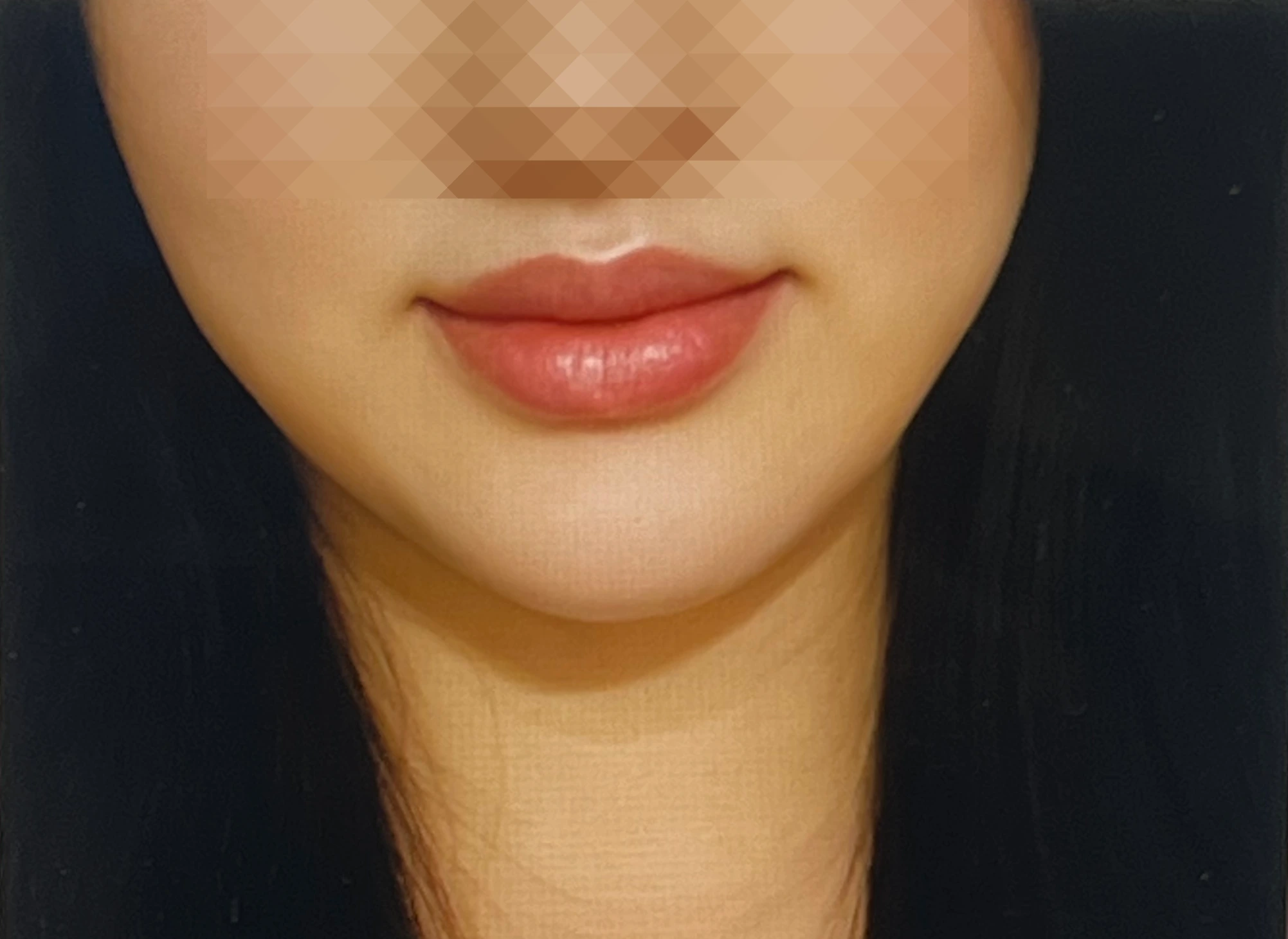 니아르-브이케어-붓기-캔디-내돈내산-후기-작성위해-찍은-내-얼굴-사진