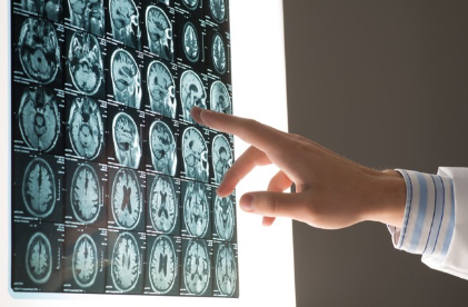 엑스레이 촬영.