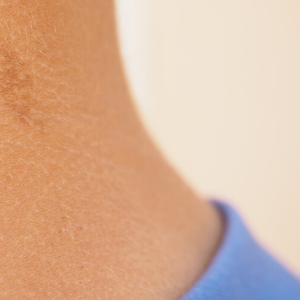 신경섬유종 초기 증상, 혹시 나도? 놓치면 안 되는 신호