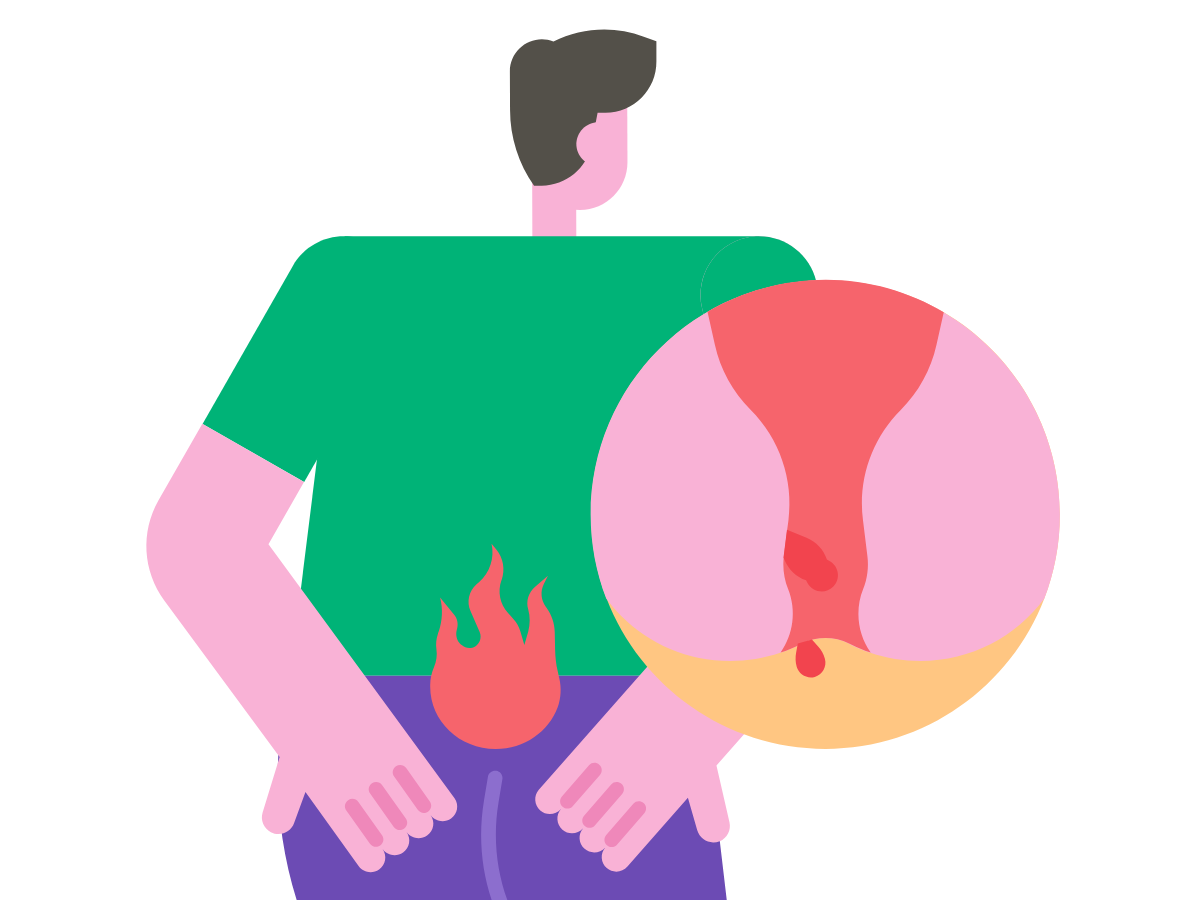 항문 열감 호소