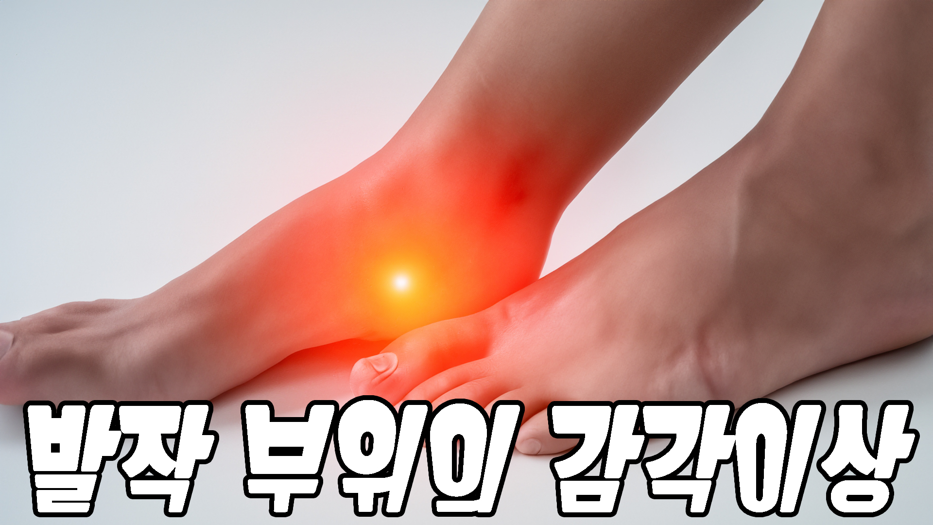 발작 부위의 감각이상