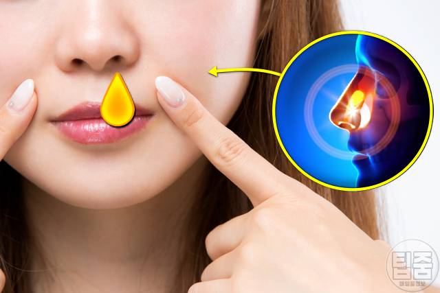 콧물 멈추는법 콧물 멈추는 약