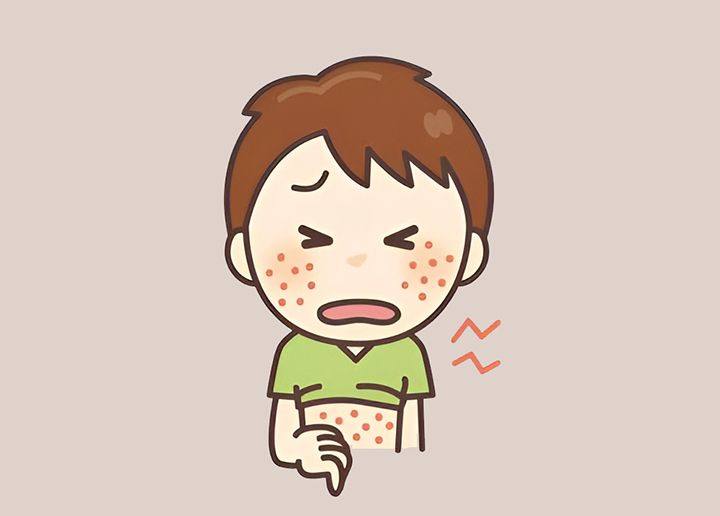 산양초유단백질-섭취로-알레르기가-생긴-아이