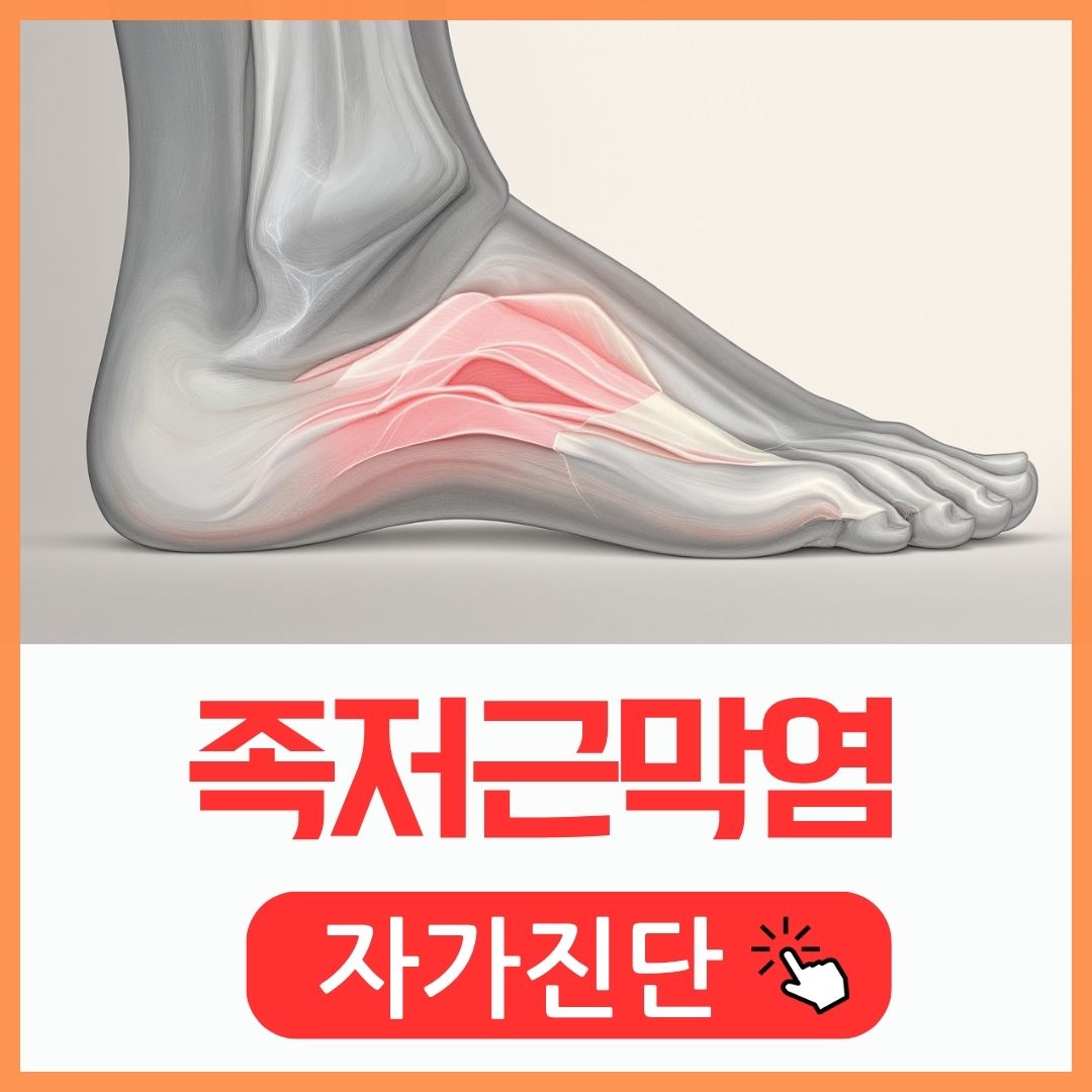 족저근막염 증상 및 자가진단_썸네일