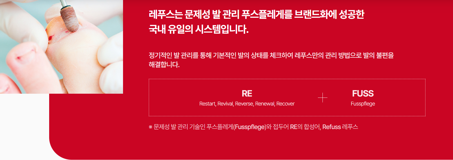 레푸스-가격