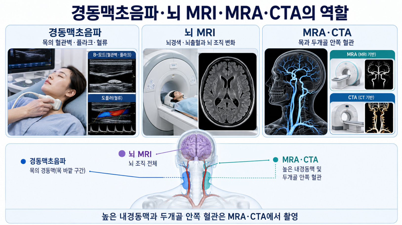 경동맥초음파 뇌 MRI MRA CTA의 관찰 부위와 역할 비교