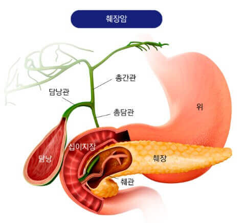 사람의 신체 부위 중 췌장의 모습