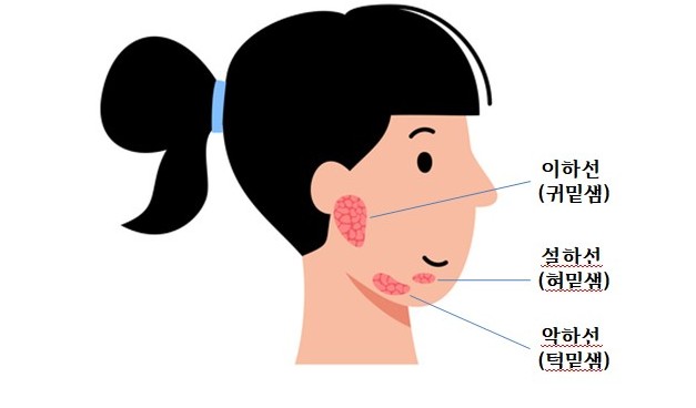 부종 턱 밑이 부었다면 어떤 질환일까 원인은 치료방법은