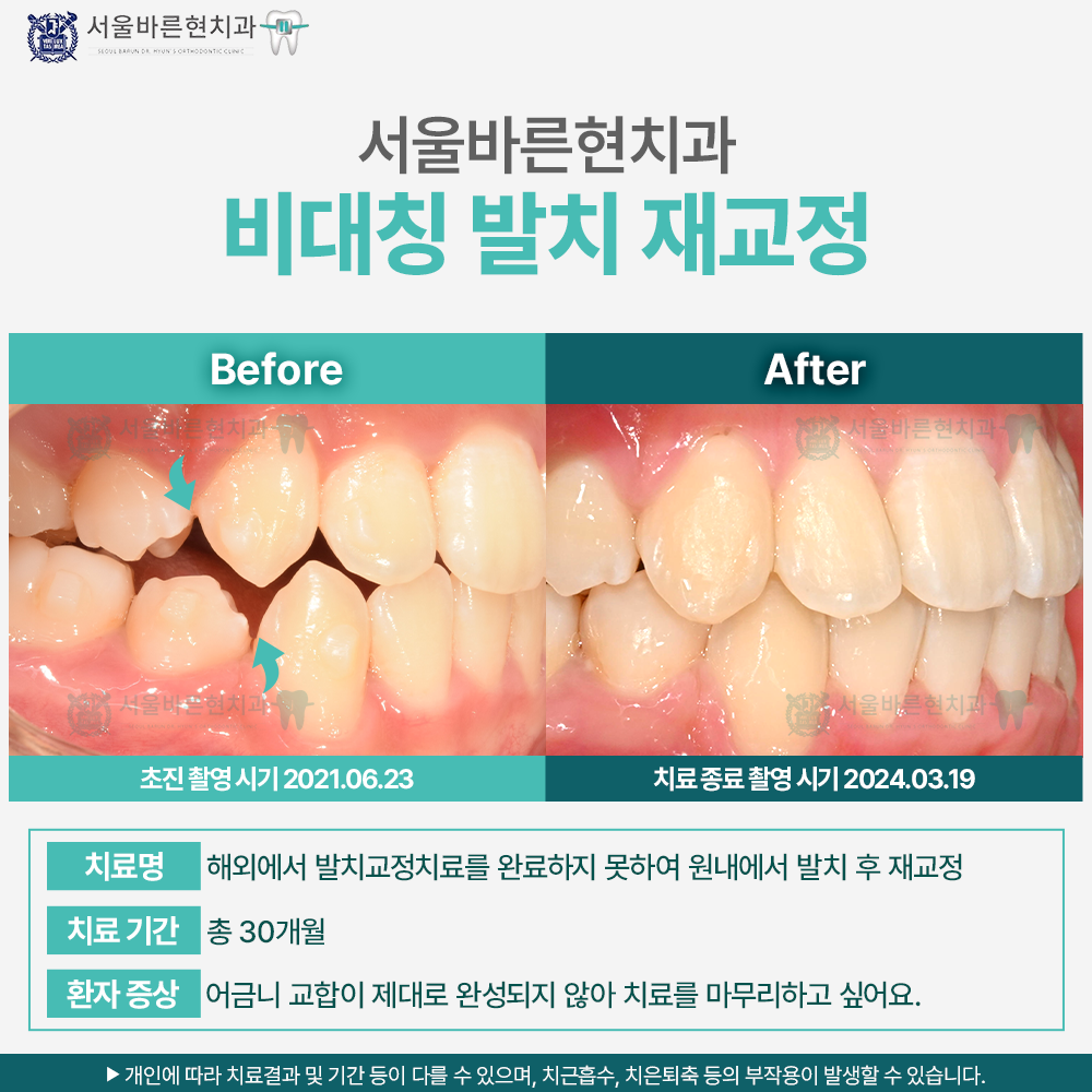 해운대교정치과