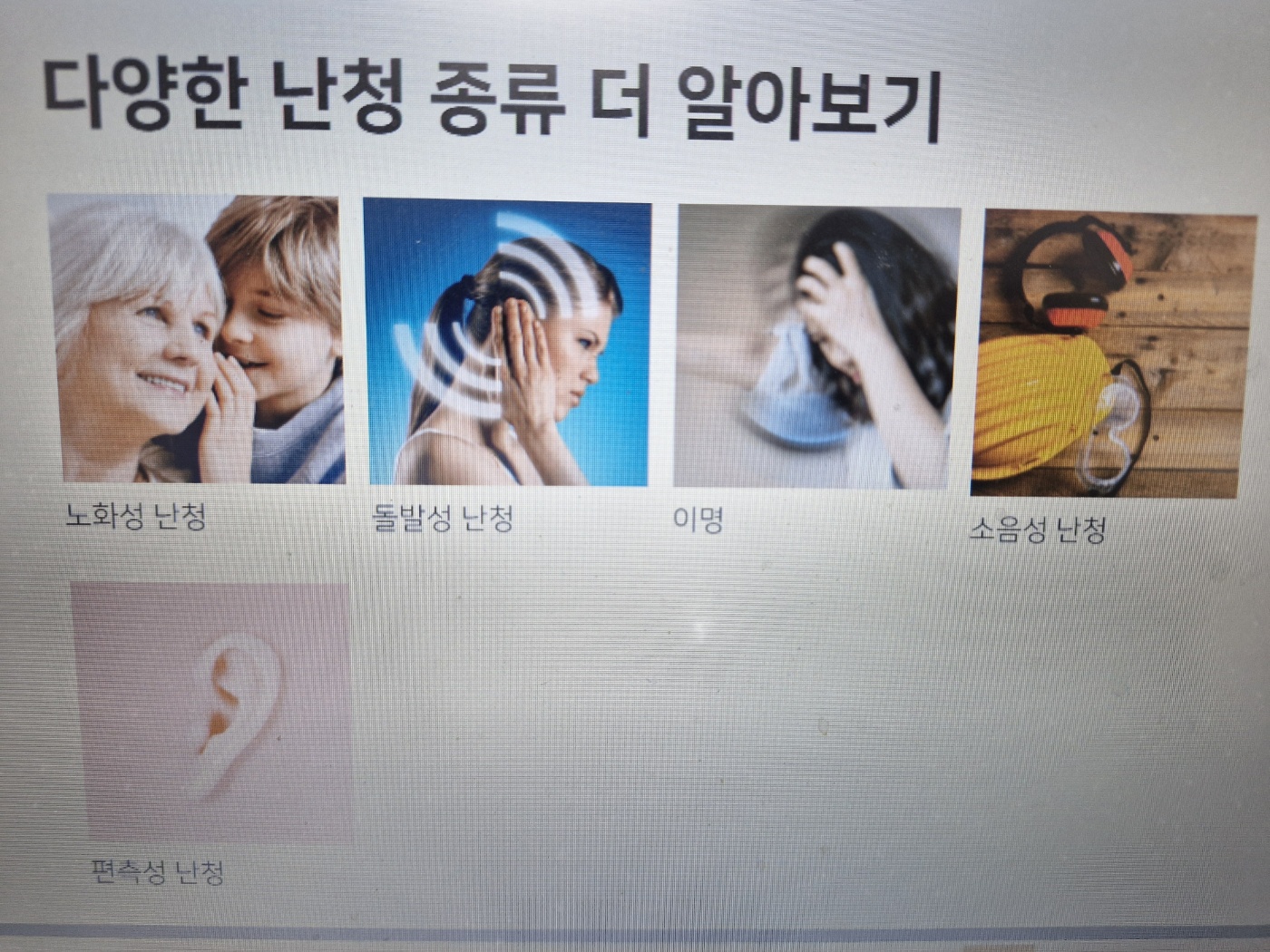 히어닷컴(Hear.com) 보청기 1달 무료 체험 후기 제10화/귀지 청소법