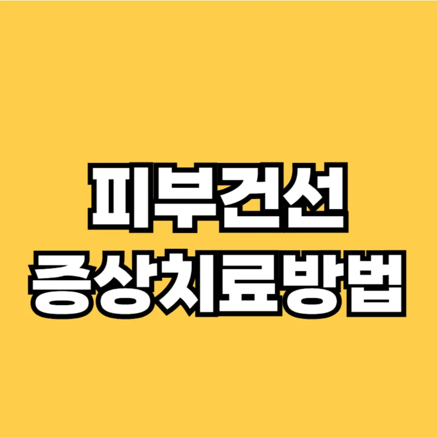 피부건선 증상