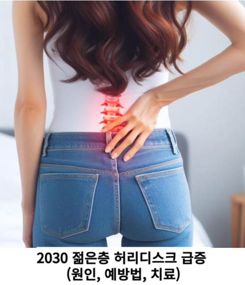 2030 젊은층 허리디스크 급증 (원인, 예방법, 치료)