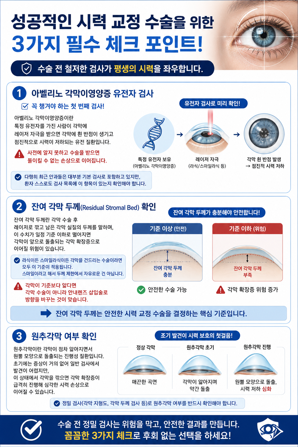 시력 교정 수술을 하기전 필수 체크 포인트 정리