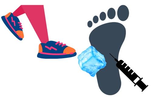 족저근막염 치료