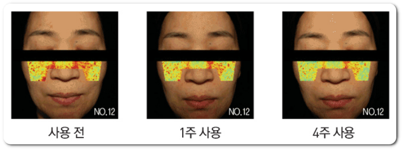 도미나스 크림 사용후기