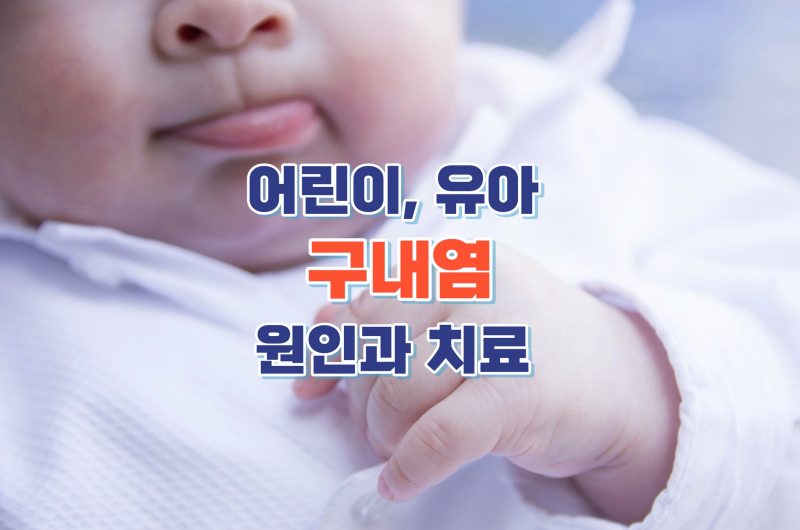 어린이-유아-구내염-원인과-치료