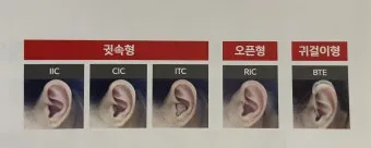 보청기 선택 귀걸이형 귓속형 배터리 교체 유지관리_10