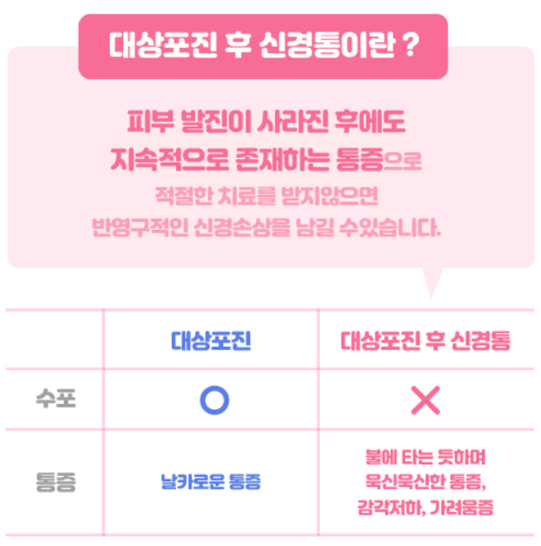 대상포진후신경통