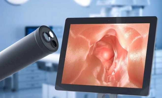 대장내시경 전 음식 주의사항