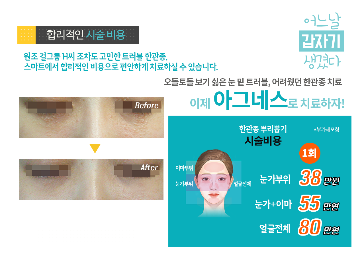 한관종 제거