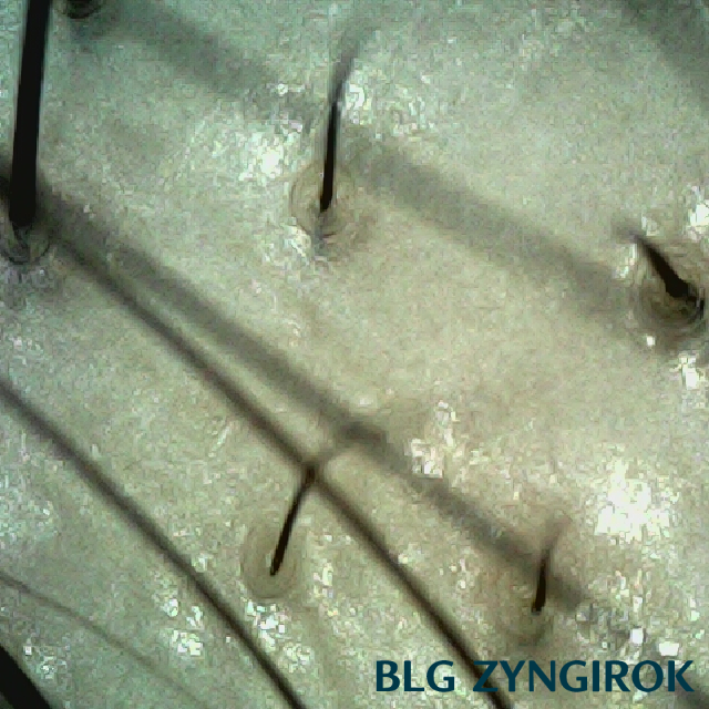 피나모아 복용 8주차 두피사진 - 정수리와 이마 사이 모습이다.