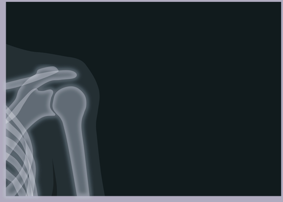 석회성건염(석회화건염)이란? 대표적인 원인 및 증상은?