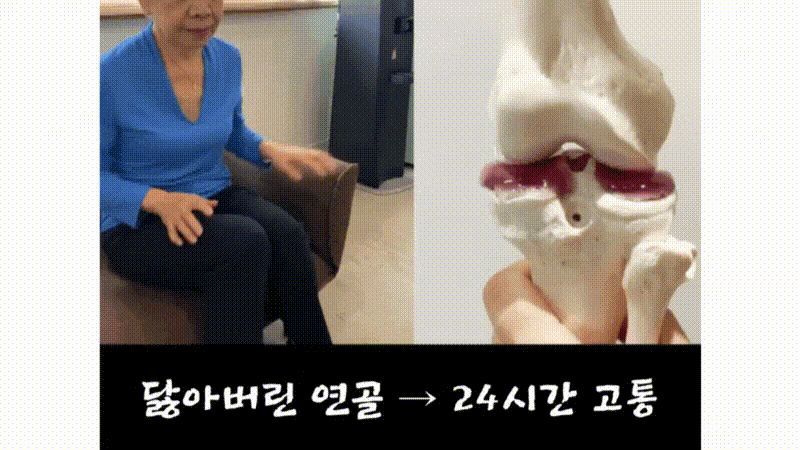 무릎관절영양제