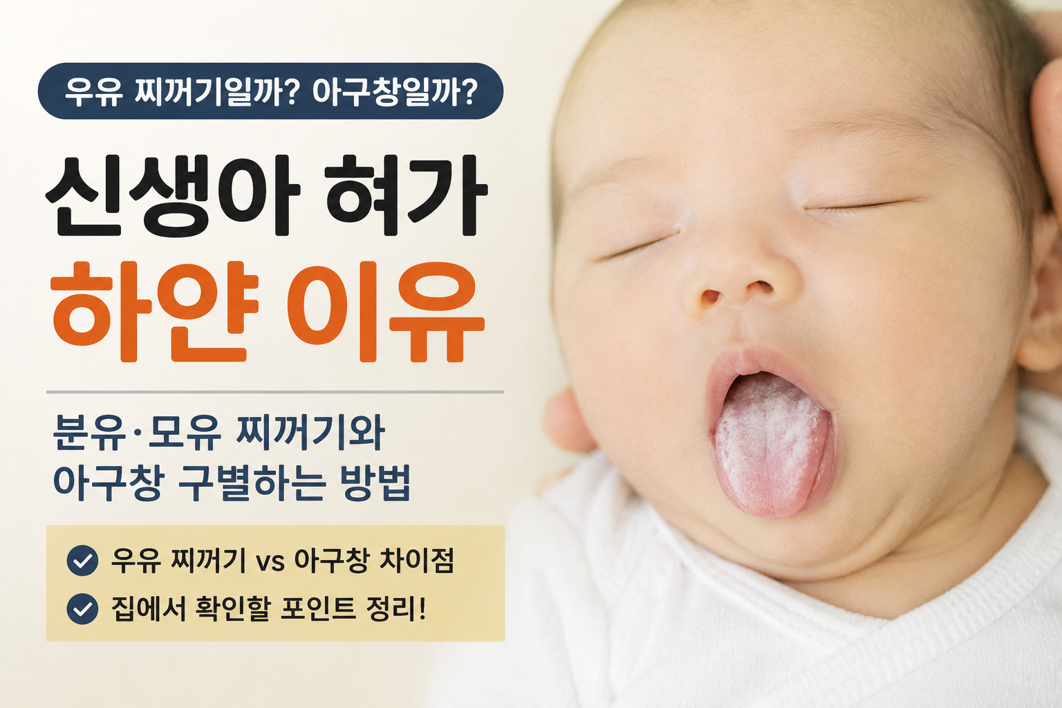 신생아 혀가 하얀이유