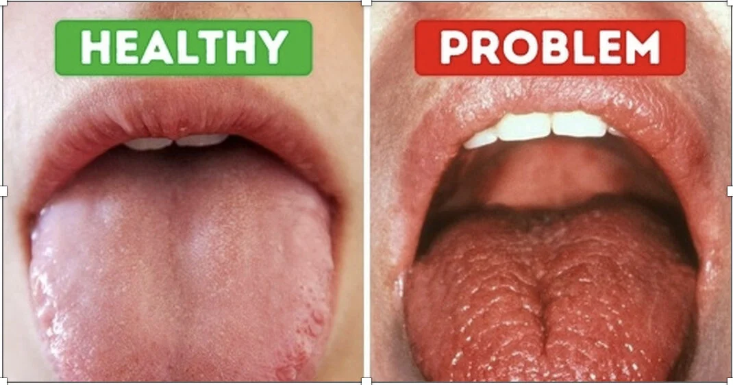 타액 분비와 건강 중요성