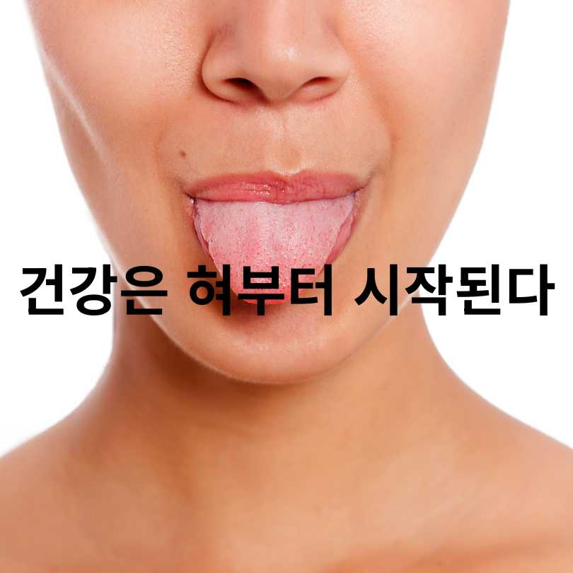 혀 건강 상태 체크법