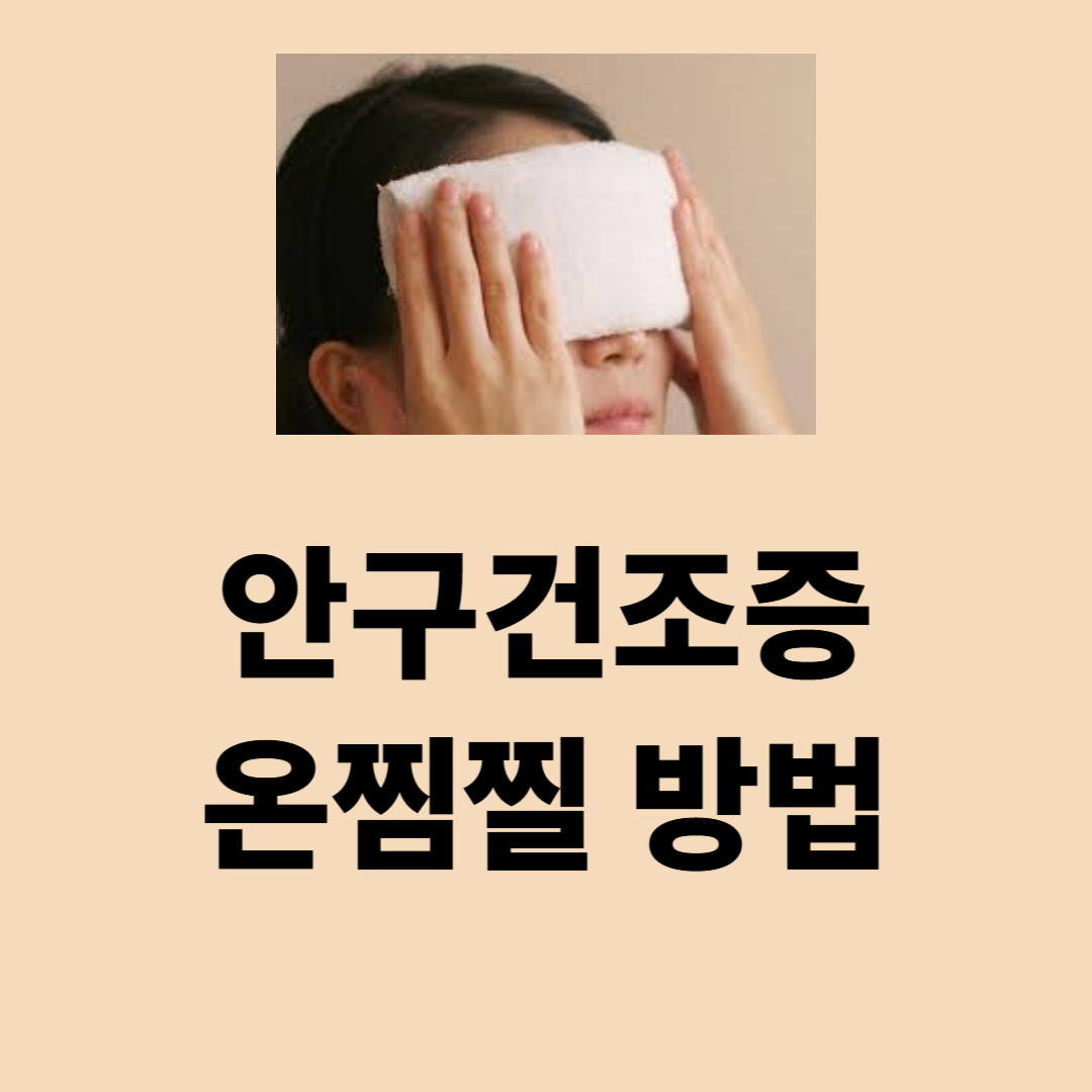 안구건조증에 효과적인 온찜질 방법