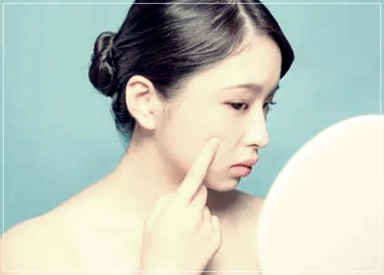 결절성 여드름 관리 잘하는 방법 3가지