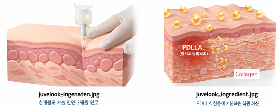 쥬베룩 PDLLA 콜라겐 생성 원리 피부 속 구조 설명