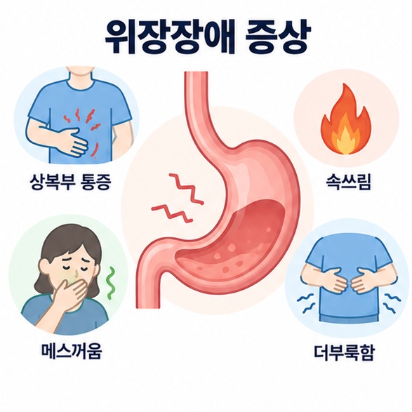 위장장애 증상 문구와 위 상복부 속쓰림 메스꺼움 더부룩함을 보여주는 의료 교육용 대표 인포그래픽