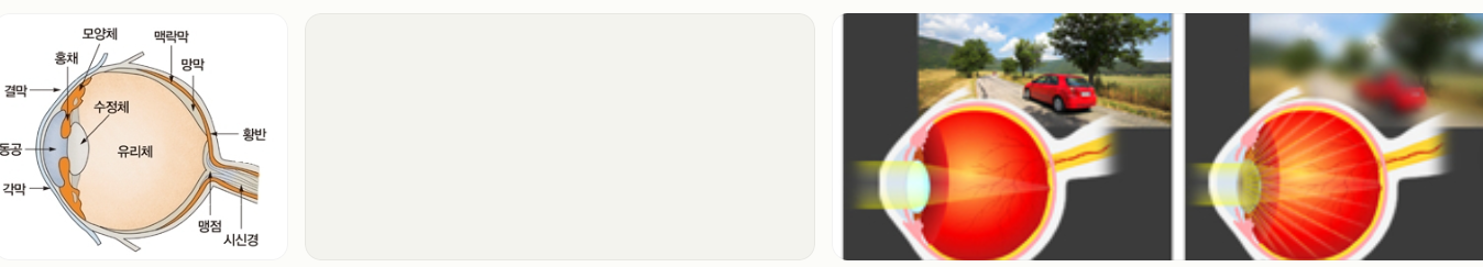 눈의 시야가 흐려지는 증상: 원인과 예방방법