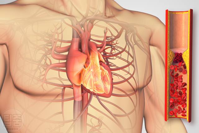 멜라토닌 부족 증상 심장 혈전 동맥경화