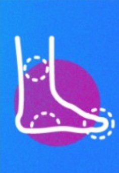 대상포진 초기 증상