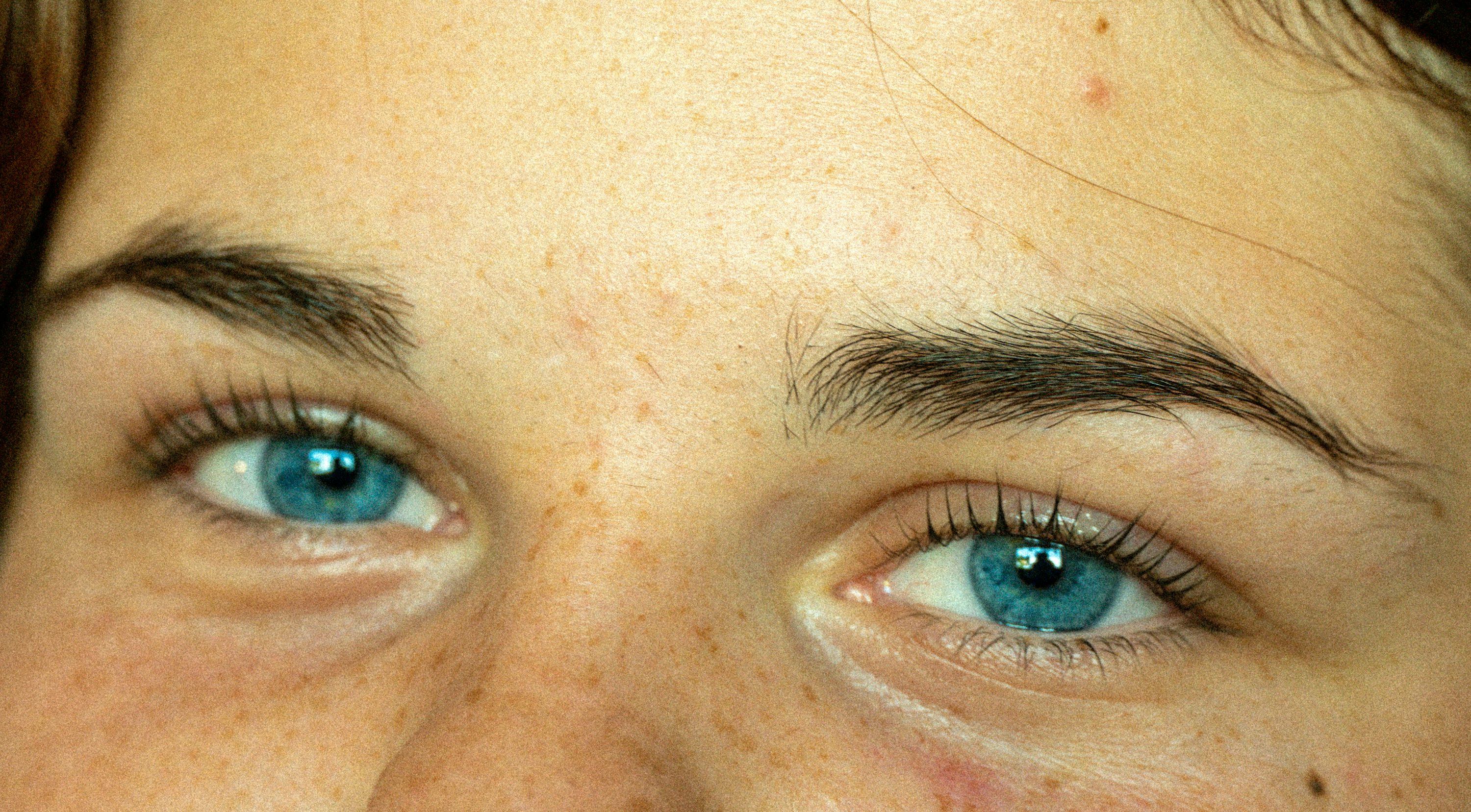 눈가 주름 없애는 법