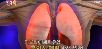 사레들리다 사레걸리다 사래들리다 맞춤법_4