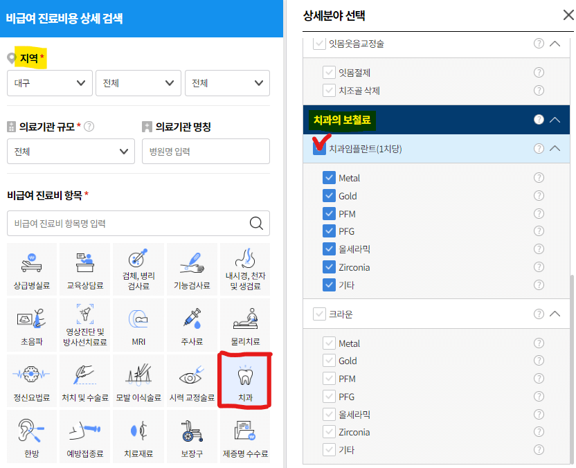 임플란트 가격