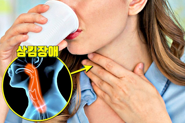 근육이 감소할때 증상,근감소증,음식 삼킴 장애