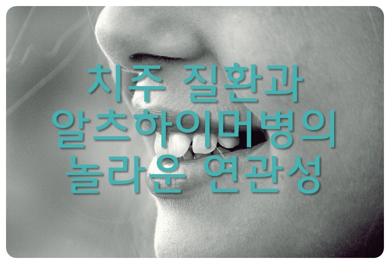 치주 질환과 알츠하이머병의 놀라운 연관성