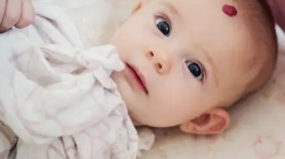 간경화 초기증상 27