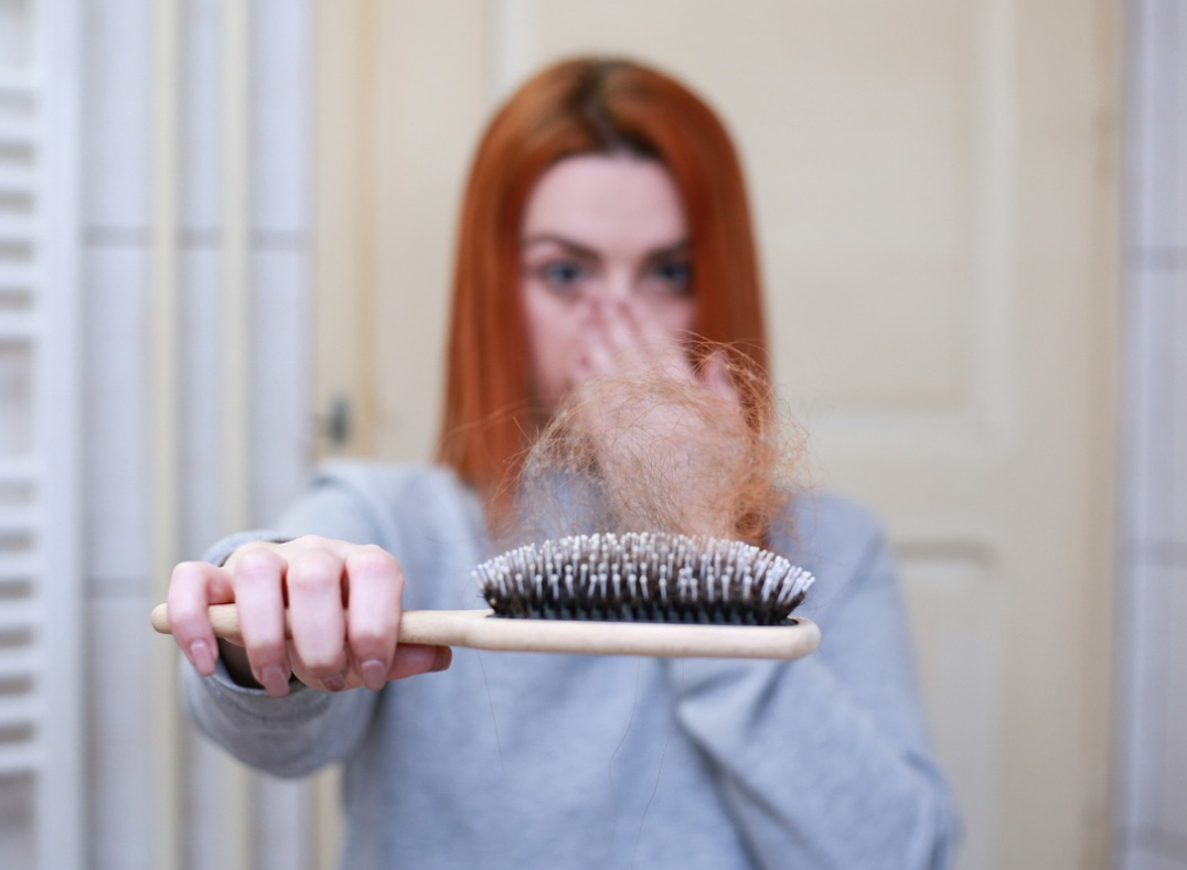 탈모 증상 원인과 치료법